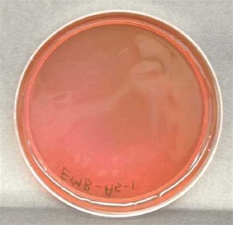 23: Eosin Methylene Blue Agar (EMB) .